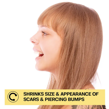 Slimoly Piercing Bump Solution